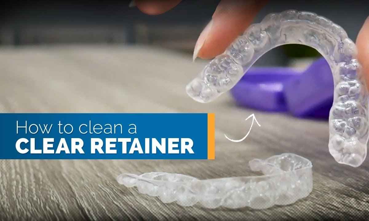 How to Clean Retainers Properly