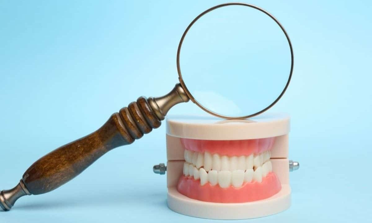how to heal cavities in 2 days at home